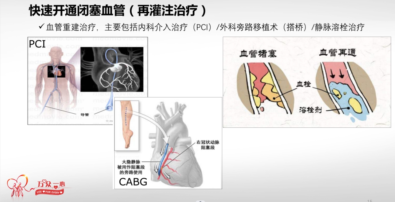 光明卫生·科普脱口秀|陈韵岱：心血管病急症救治，早一点再快一点